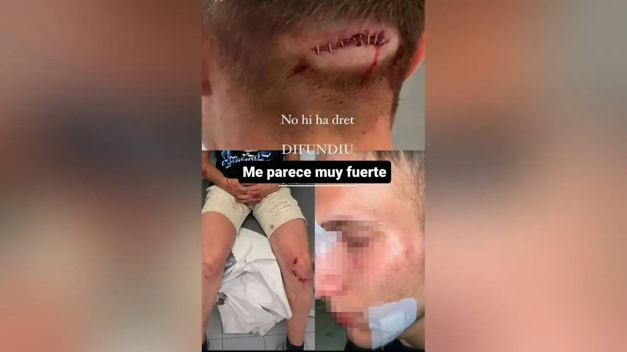 Joven agredido en Alginet (Valencia)