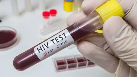 Prueba del VIH moléculas del semen frenan la transmisión de una variante del VIH