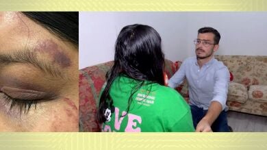 La mujer que fue taladrada en la cabeza por su pareja: 