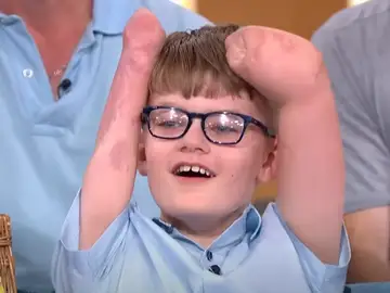 El pequeño Luke explicando cómo le amputaron las piernas y brazos El pequeño Luke explicando cómo le amputaron las piernas y brazos