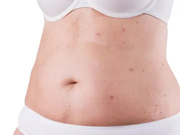 Barriga de una mujer Barriga de una mujer