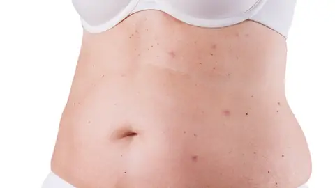 Barriga de una mujer Barriga de una mujer