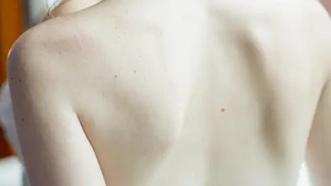 Espalda de mujer Espalda de mujer