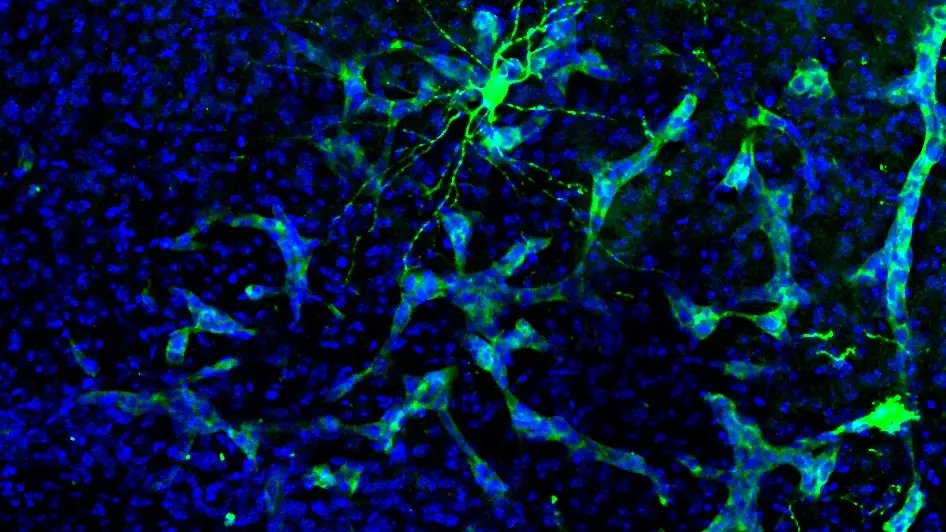 Metástasis cerebral en un ratón Metástasis cerebral en un ratón
