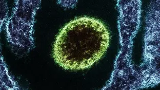 Virus mortal Nipah Virus mortal Nipah