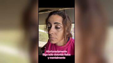 La mujer agredida en Kenia La mujer agredida en Kenia
