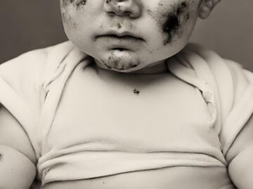 Una imagen de archivo de un bebé con quemaduras