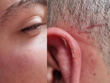 Menor agredido en un partido de juveniles en Villaverde del Río en Sevilla