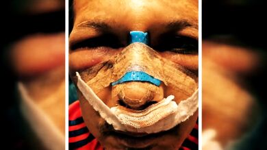 La pesadilla de Hernán y Alicia en Turquía al someterse a una cirugía estética 'low cost': 