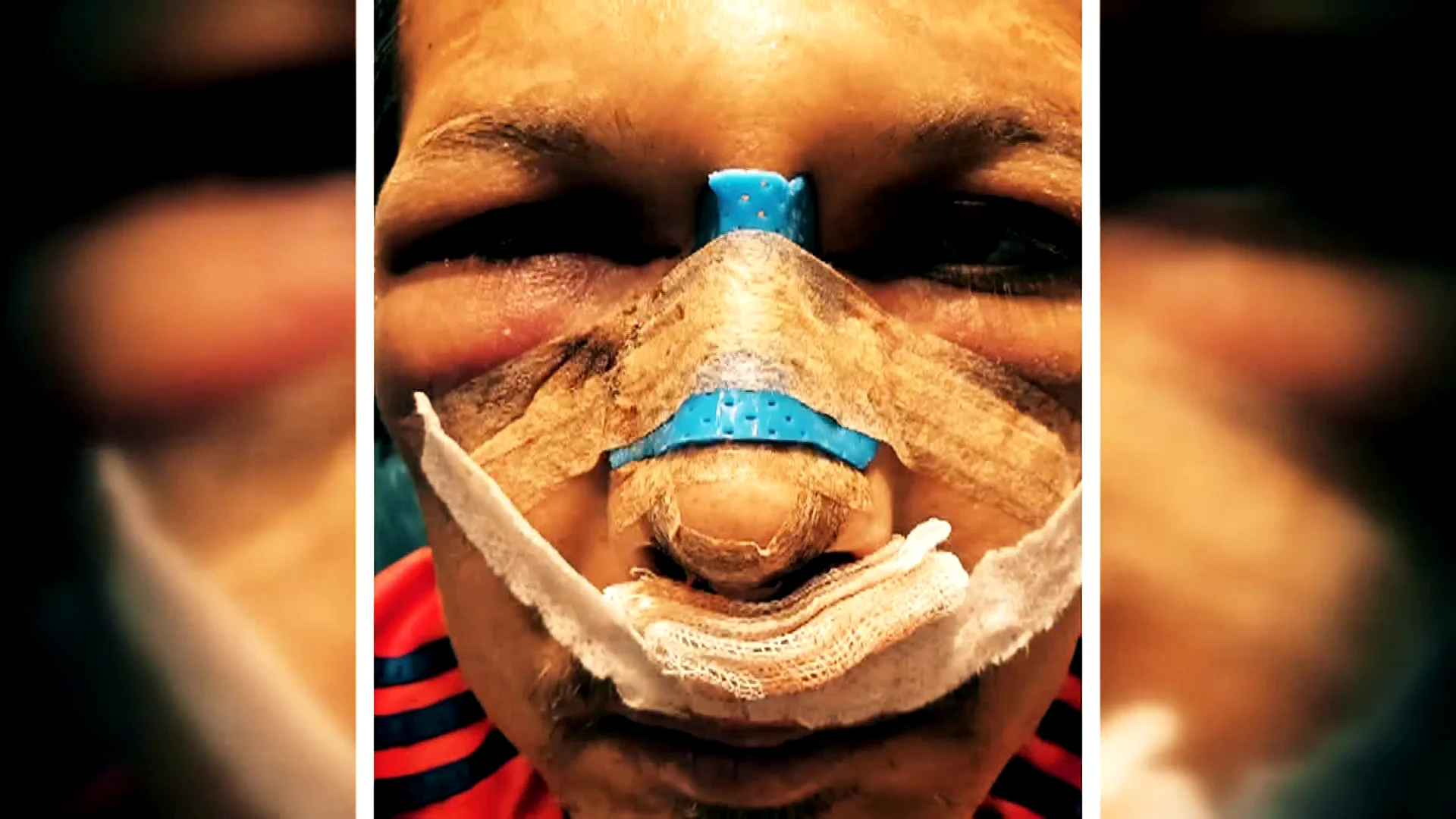 El terror de Alicia y Hernán en Turquía para someterse a una cirugía estética 'low cost': "El precio fue decisivo" El terror de Alicia y Hernán en Turquía para someterse a una cirugía estética 'low cost': "El precio fue decisivo"