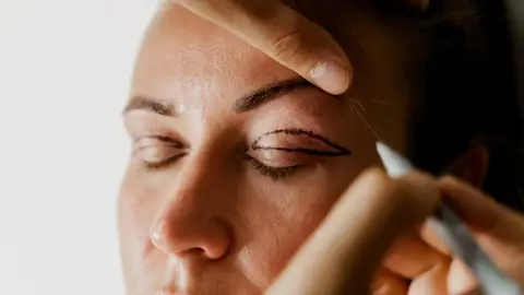 Tratamientos contra el párpado caído Tratamientos contra el párpado caído