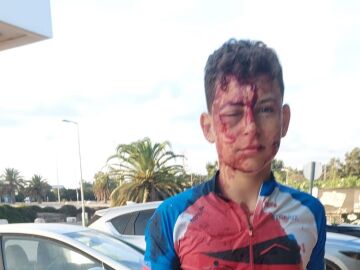 Joven ciclista herido por los ataques de Hamás