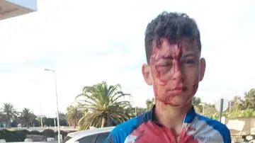 Joven ciclista herido por los ataques de Hamás