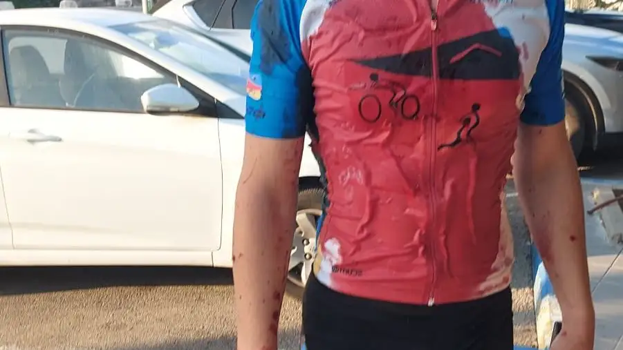 Joven ciclista herido por los ataques de Hamás Joven ciclista herido por los ataques de Hamás