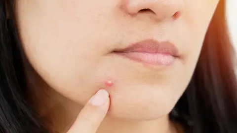 Mujer con un grano Mujer con un grano