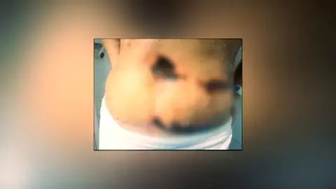 La vida de Yurena, en riesgo tras someterse a una abdominoplastia en Turquía La vida de Yurena, en riesgo tras someterse a una abdominoplastia en Turquía