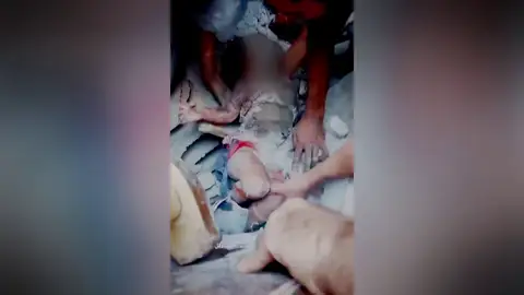 Un menor rescatado de entre los escombros tras los bombardeos Un menor rescatado de entre los escombros tras los bombardeos