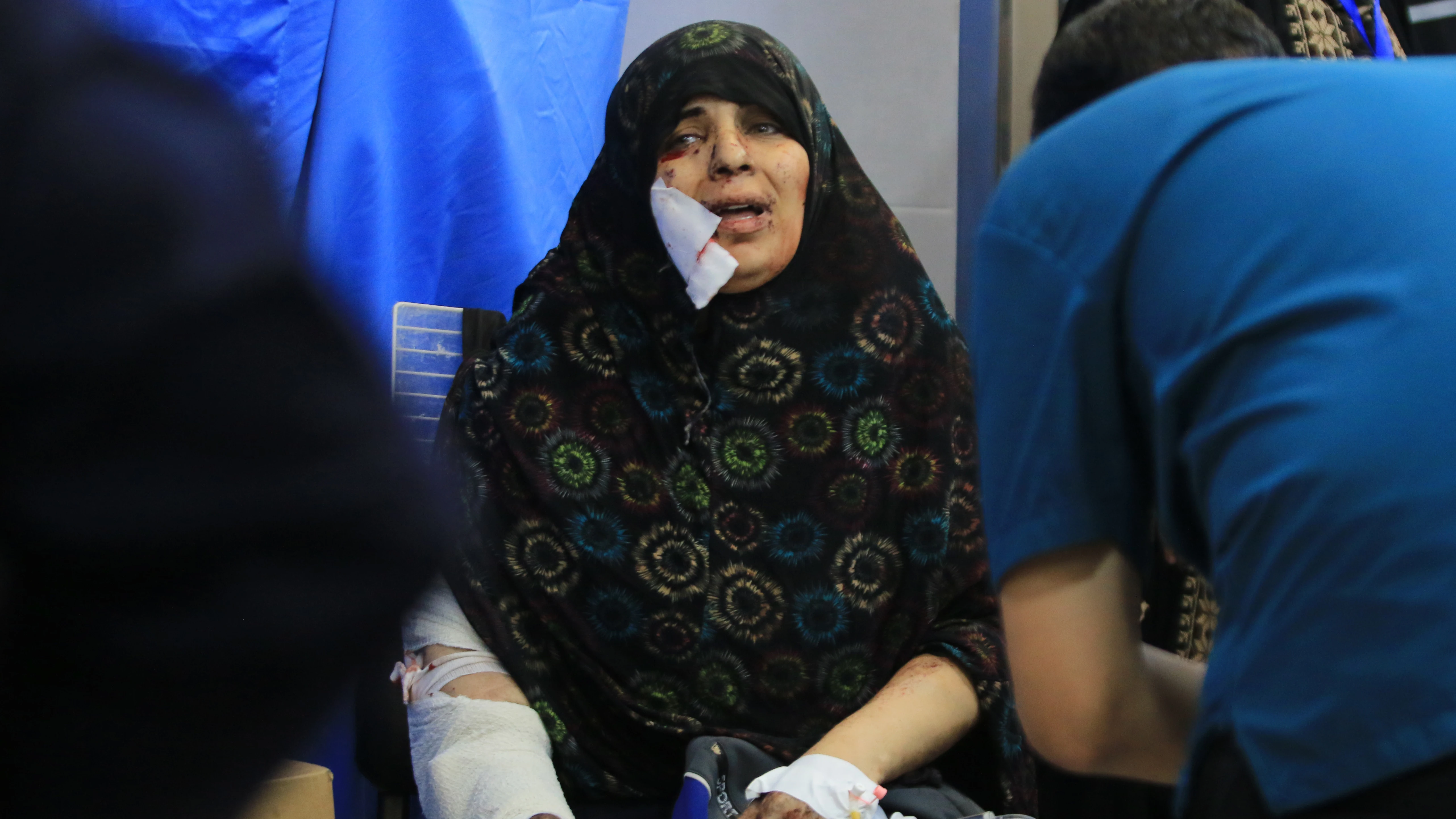 Una mujer atendida en un hospital de Gaza