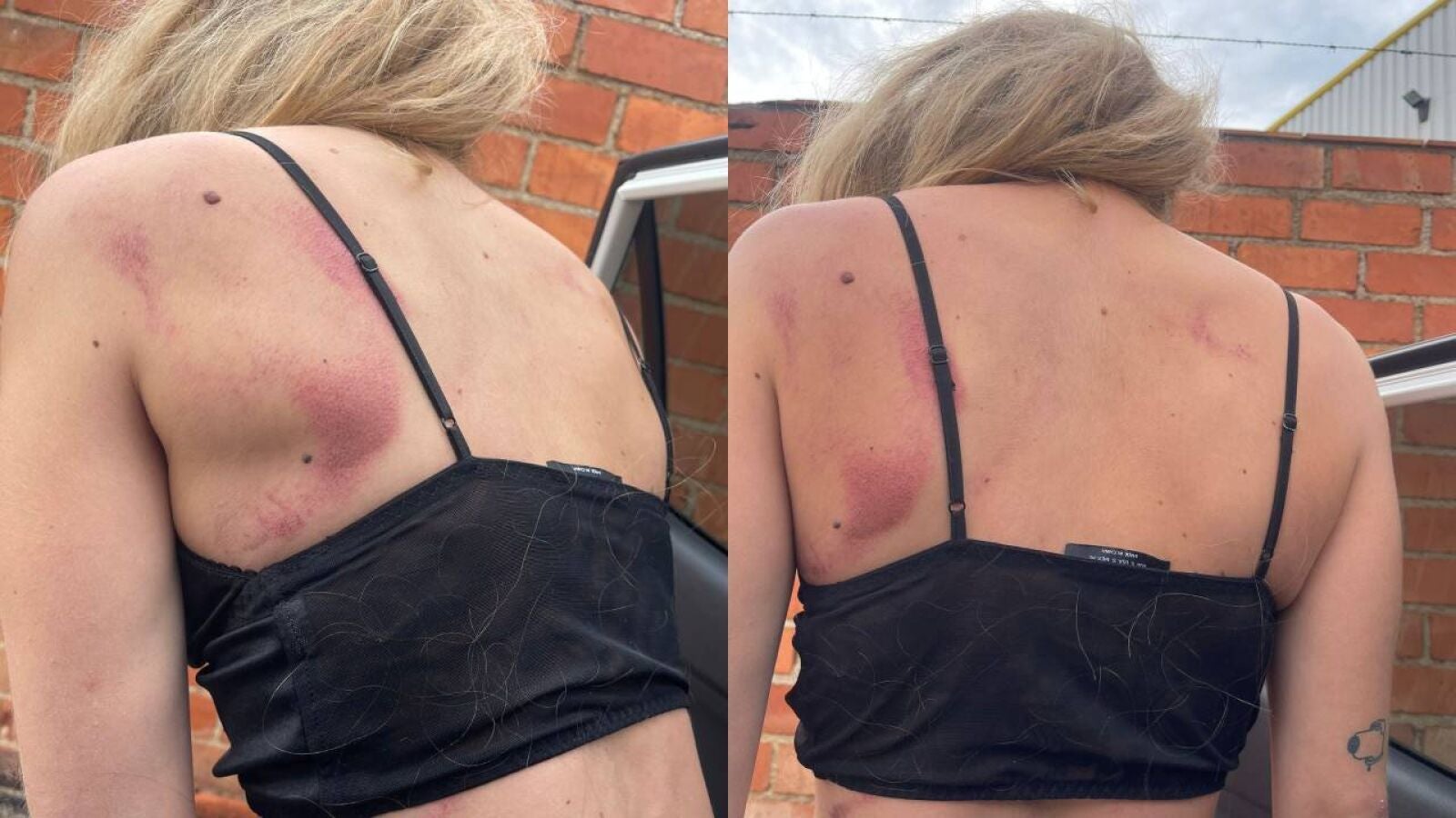 Brutal paliza a una joven en Castellón por defender a una amiga: 