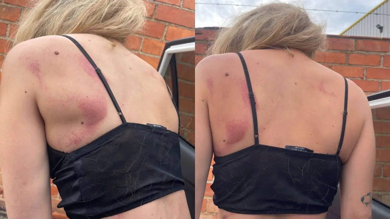 Joven agredida en una discoteca de Castell&oacute;n tras defender a una amiga