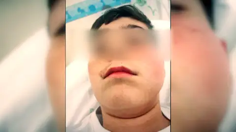 Las amenazas del vecino que agredió a un menor por el ruido de una pelota continúan: "Se está volviendo insostenible" Las amenazas del vecino que agredió a un menor por el ruido de una pelota continúan: "Se está volviendo insostenible"