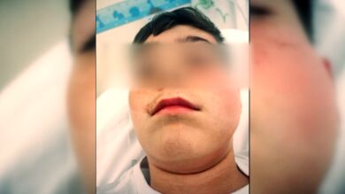 Las amenazas del vecino que agredió a un menor por el ruido de una pelota continúan: 