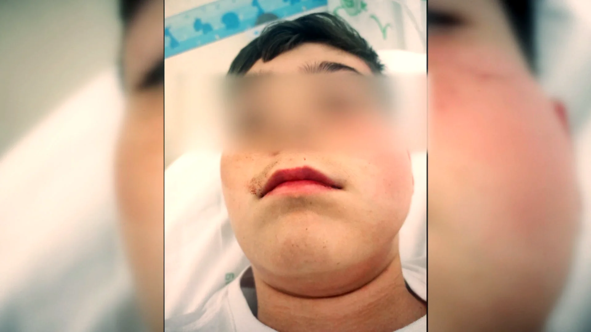 Las amenazas del vecino que agredió a un menor por el ruido de una pelota continúan: "Se está volviendo insostenible" Las amenazas del vecino que agredió a un menor por el ruido de una pelota continúan: "Se está volviendo insostenible"