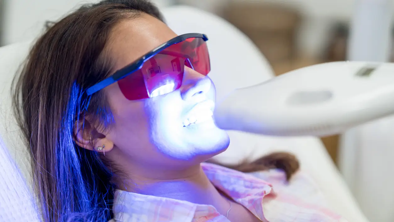 Blanqueamiento dental Blanqueamiento dental