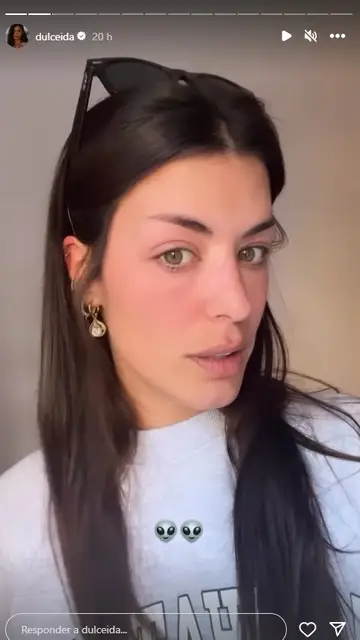 Dulceida sufre una reacción alérgica Dulceida sufre una reacción alérgica