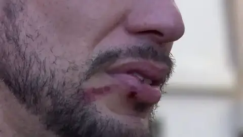 Denuncia a una discoteca por una presunta agresión homófoba y lo acusan de denuncia falsa: "Me empezaron a pegar" Denuncia a una discoteca por una presunta agresión homófoba y lo acusan de denuncia falsa: "Me empezaron a pegar"