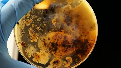 Imagen de una muestra de bacterias