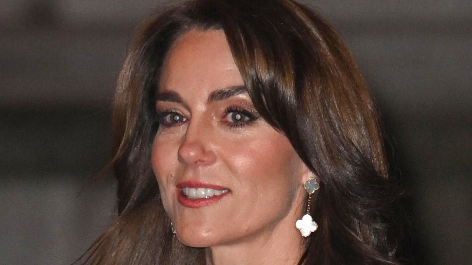 La operación abdominal de Kate Middleton no está relacionada con un problema 