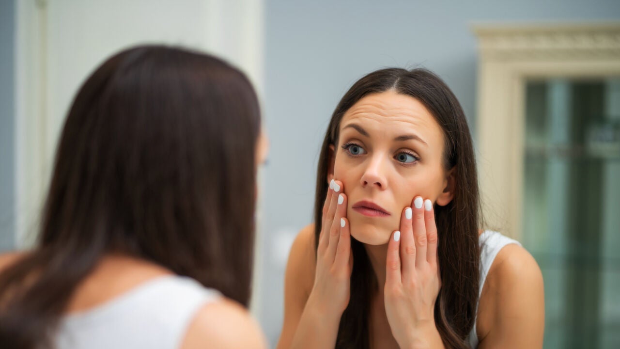 ¿Qué son las bunny lines? Las arrugas que no tienes en cuenta hasta que