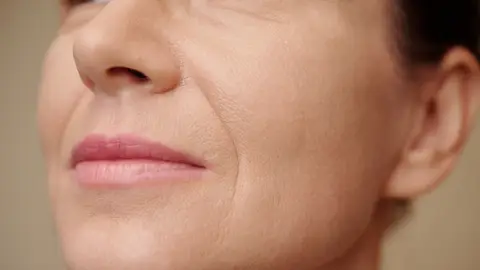 Arrugas de conejo Arrugas de conejo