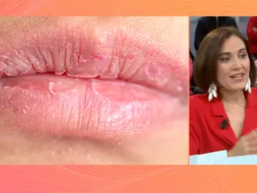 Protege la piel frente al frío: Boticaria García nos da las claves para cuidarla Protege la piel frente al frío: Boticaria García nos da las claves para cuidarla