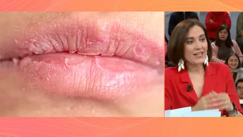 Protege la piel frente al frío: Boticaria García nos da las claves para cuidarla Protege la piel frente al frío: Boticaria García nos da las claves para cuidarla