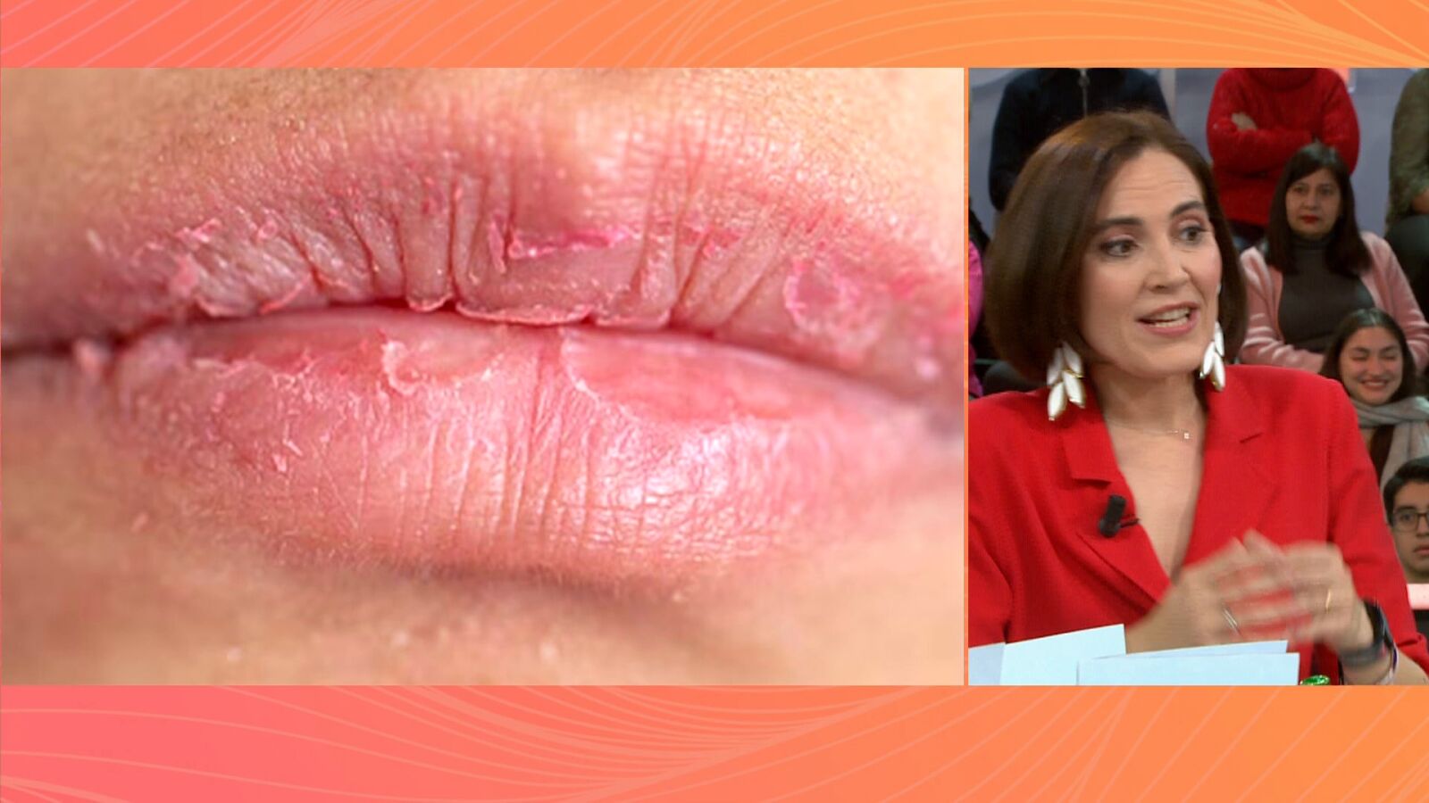 Protege la piel frente al frío: Boticaria García nos da las claves para cuidarla