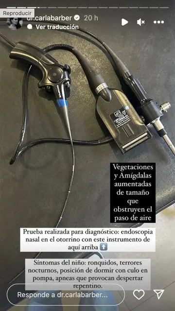 Carla Barber cuenta que su hijo Bastian tendrá que pasar por quirófano Carla Barber cuenta que su hijo Bastian tendrá que pasar por quirófano