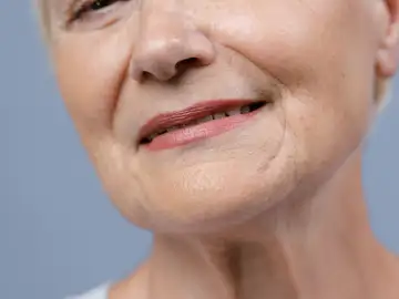 Arrugas alrededor de la boca Arrugas alrededor de la boca