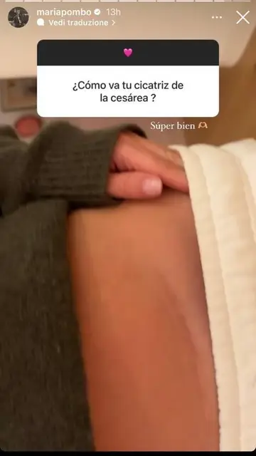 María Pombo ha enseñado en stories de Instagram el estado de su cicatriz María Pombo ha enseñado en stories de Instagram el estado de su cicatriz