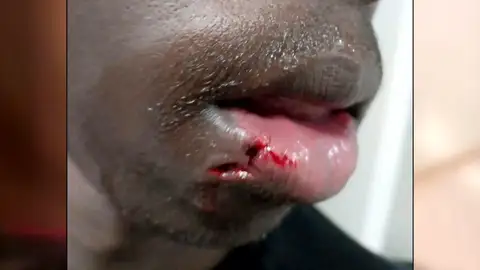 Uno de los jóvenes agredidos Uno de los jóvenes agredidos