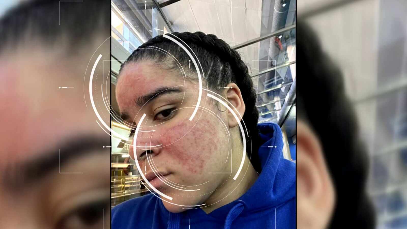 María es alérgica al agua, piscis y profesora de piscina: 