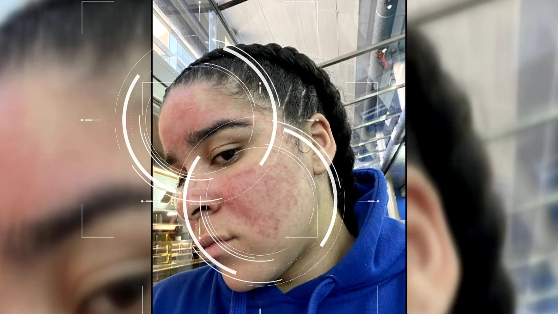 Mar&iacute;a es al&eacute;rgica al agua y es profesora de piscina: "No pasa nada tener esta reacci&oacute;n, yo estoy disfrutando"