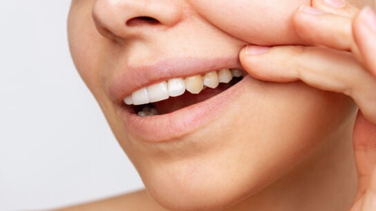 Dientes