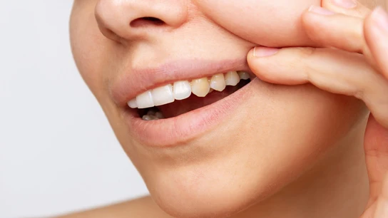 Dientes Dientes