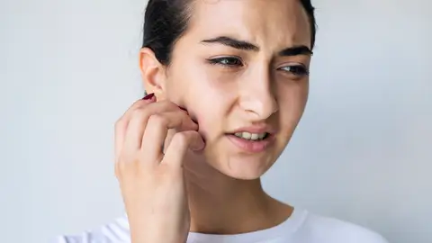 Mujer se rasca la piel de la cara Mujer se rasca la piel de la cara