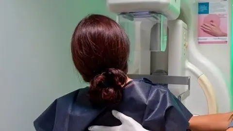 Imagen de recurso de mamografía Imagen de recurso de mamografía