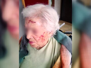 Una cuidadora de residencia agrede a una anciana de 93 años y la condenan a indemnizarla con apenas 210 euros