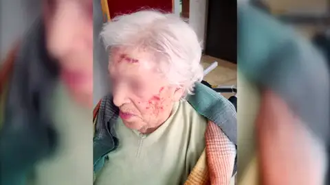 Una cuidadora de residencia agrede a una anciana de 93 años y la condenan a indemnizarla con apenas 210 euros Una cuidadora de residencia agrede a una anciana de 93 años y la condenan a indemnizarla con apenas 210 euros