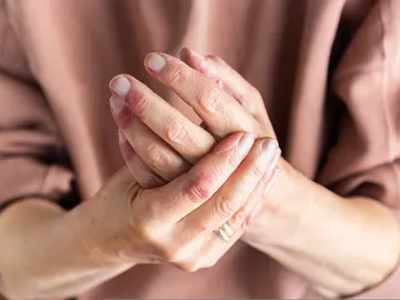 Manos secas y estropeadas Manos secas y estropeadas